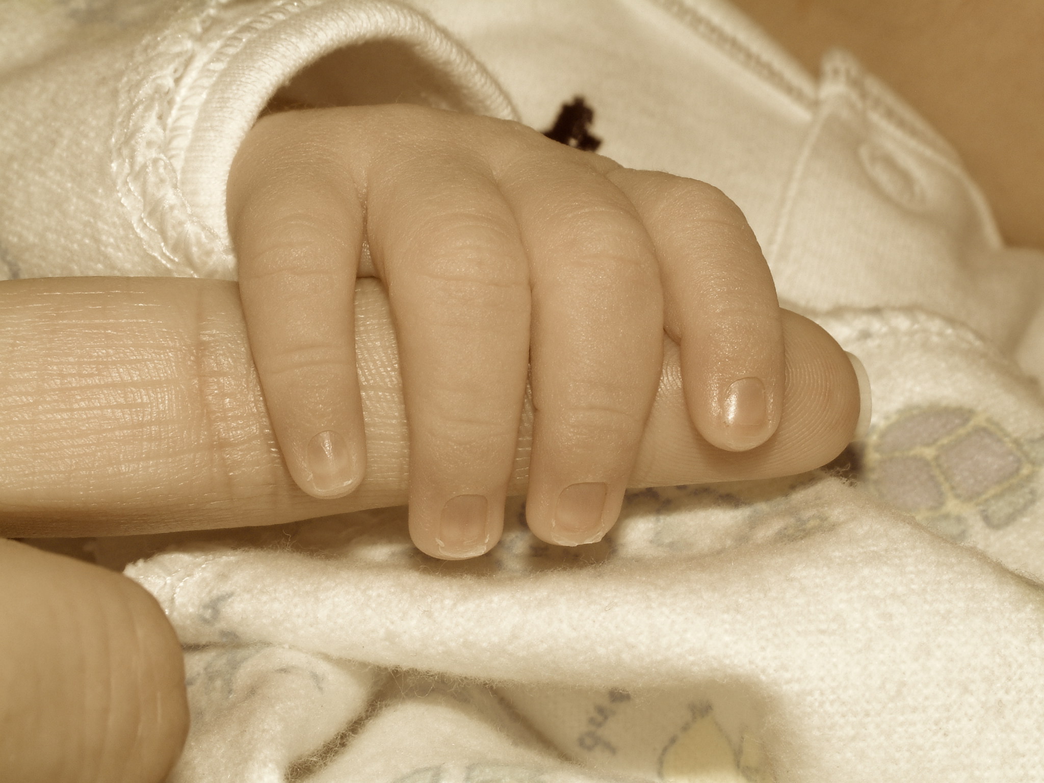 Пальчики грудничков. Ногти новорожденного ребенка. Ногти новорождённых детей. Прыщик на пальце у ребенка.